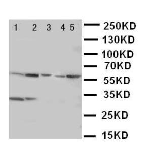 Anti-ASIC3 Rabbit Polyclonal Antibody