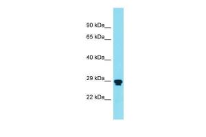 Anti-RNF151 Rabbit Polyclonal Antibody