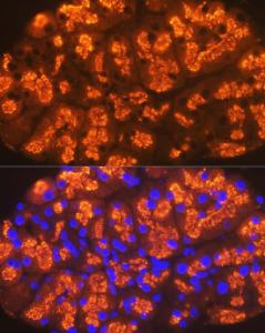 Immunofluorescence analysis of rat pancreas cells using Anti-CTRL Antibody [ARC2218] (A306145) at a dilution of 1:100 (40x lens). DAPI was used to stain the cell nuclei (blue)