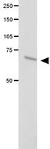 Anti-FANCC Polyclonal Antibody