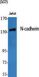 Western blot analysis of various cells using Anti-CDH2 Antibody