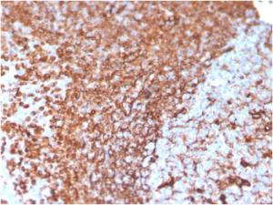 Anti-Vimentin antibody