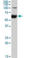 Anti-HNF1B Goat Polyclonal Antibody