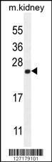 Anti-CALML4 Rabbit Polyclonal Antibody (FITC (Fluorescein Isothiocyanate))