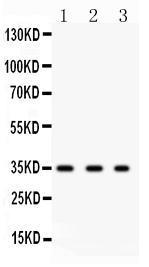 Anti-SPARC Rabbit Polyclonal Antibody