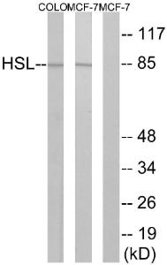 Western blot analysis of lysates from COLO and MCF7 cells using Anti-HSL Antibody. The right hand lane represents a negative control, where the antibody is blocked by the immunising peptide