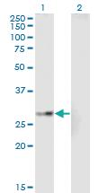 Anti-EPHA7 Mouse Monoclonal Antibody [clone: 1G11]