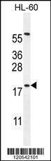 Anti-DPPA5 Rabbit Polyclonal Antibody (FITC (Fluorescein Isothiocyanate))