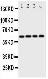 Anti-SQSTM1/p62 Rabbit Polyclonal Antibody