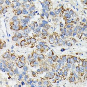 Anti-MT-CYB antibody