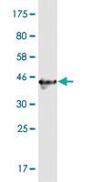 Anti-CCDC115 Mouse Monoclonal Antibody [clone: 4E9]