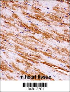 Anti-MAP3K1 Rabbit Polyclonal Antibody