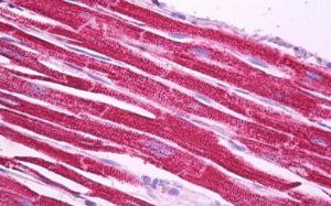 Anti-NDUFS1 Antibody (A84841) (5µg/ml) staining of paraffin embedded Human Heart. Steamed antigen retrieval with citrate buffer pH 6, AP-staining.