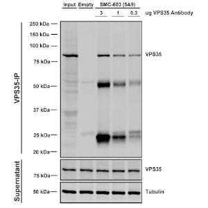 Immunoprecipitation analysis of mouse embryonic fibroblast using Anti-VPS35 Antibody [5A9] (A305033)