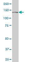 Anti-PTCH1 Mouse Monoclonal Antibody [clone: 3B3]