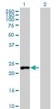 Anti-PPP1R17 Mouse Polyclonal Antibody