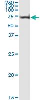 Anti-AKT1 Antibody Pair