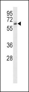 Anti-ACVR2B Rabbit Polyclonal Antibody (Biotin)