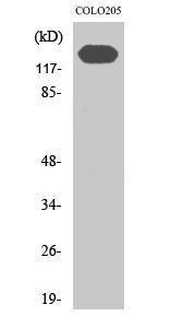 Western blot analysis of K562 cells using Anti-CDH2 Antibody