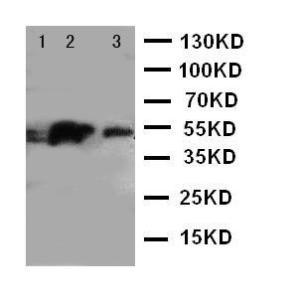 Anti-IRAK4 Rabbit Polyclonal Antibody