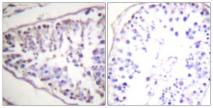 Immunohistochemical analysis of paraffin-embedded human tonsil tissue using Anti-HSL Antibody. The right hand panel represents a negative control, where the antibody was pre-incubated with the immunising peptide