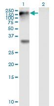 Anti-EPHB1 Mouse Monoclonal Antibody [clone: 4G6]