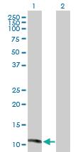 Anti-MGP Rabbit Polyclonal Antibody