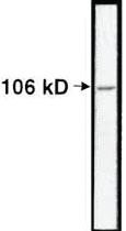 Anti-NCL Rabbit Polyclonal Antibody