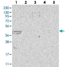 Anti-LIPT1 Rabbit Polyclonal Antibody