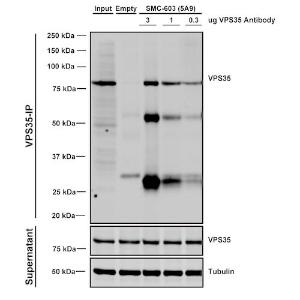 Immunoprecipitation analysis of mouse embryonic fibroblast using Anti-VPS35 Antibody [5A9] (A305033)