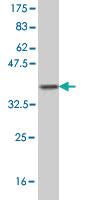 Anti-MUSK Mouse Monoclonal Antibody [clone: 4C4]