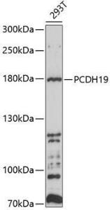 Anti-PCDH19 Antibody (A8519)