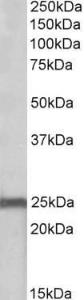 Anti-NDUFS8 Antibody (A84843) (0.1 µg/ml) staining of Mouse Heart lysate (35 µg protein in RIPA buffer). Primary incubation was 1 hour. Detected by chemiluminescence