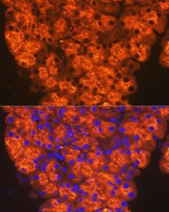 Immunofluorescence analysis of mouse pancreas cells using Anti-CTRL Antibody [ARC2218] (A306145) at a dilution of 1:100 (40x lens). DAPI was used to stain the cell nuclei (blue)