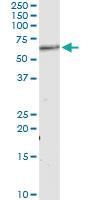 Anti-AKT1 Antibody Pair