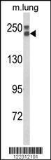 Anti-COL18A1 Rabbit Polyclonal Antibody (AP (Alkaline Phosphatase))