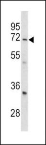 Anti-GARP Rabbit polyclonal antibody