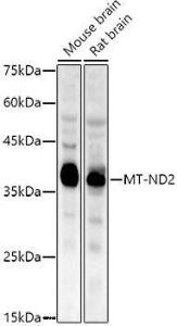 Western blot analysis of extracts of various cell lines, using Anti-NADH2 [9E12-1B3] Antibody (A92937) at 1:1,000 dilution The secondary antibody was Goat Anti-Rabbit IgG H&L Antibody (HRP) at 1:10,000 dilution Lysates/proteins were present at 25 µg per lane