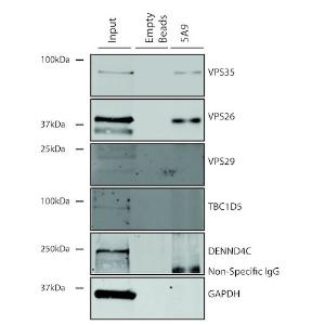 Immunoprecipitation analysis of mouse embryonic fibroblast using Anti-VPS35 Antibody [5A9] (A305033)