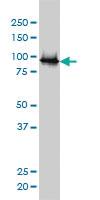 Anti-UBE3A Mouse Monoclonal Antibody [clone: 2F6]