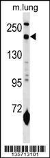 Anti-MRC1L1 Rabbit Polyclonal Antibody (FITC (Fluorescein Isothiocyanate))