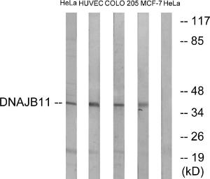 Western blot analysis of lysates from HeLa, HUVEC, COLO, and MCF-7 cells using Anti-DNAJB11 Antibody. The right hand lane represents a negative control, where the antibody is blocked by the immunising peptide