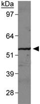 Anti-SLC2A9 Rabbit Polyclonal Antibody