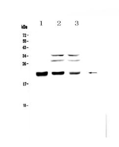 Anti-CBFb Polyclonal Antibody