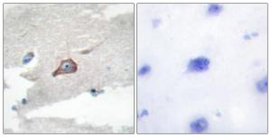 Immunohistochemical analysis of paraffin-embedded human brain tissue using Anti-HCK Antibody. The right hand panel represents a negative control, where the antibody was pre-incubated with the immunising peptide