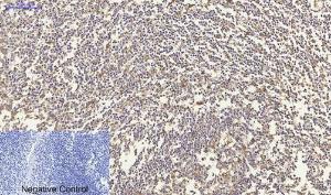 Immunohistochemical analysis of paraffin-embedded human Tonsil tissue using Anti-CDH2 Antibody at 1:200 (4 °C overnight). Negative control was secondary antibody only