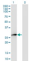 Anti-HPGD Mouse Monoclonal Antibody [clone: 1D8]