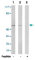 Anti-PARK2 Rabbit Polyclonal Antibody