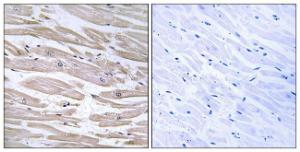 Immunohistochemical analysis of paraffin-embedded human heart tissue using Anti-DNAJB11 Antibody. The right hand panel represents a negative control, where the antibody was pre-incubated with the immunising peptide