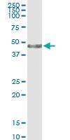 Anti-CK34 Polyclonal Antibody Pair